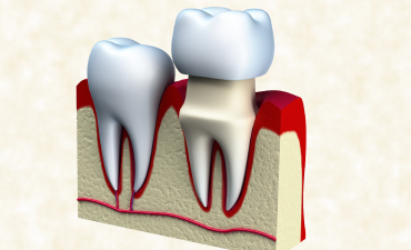whittlessey-dental-treatment-picture